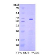 SDS-PAGE analysis of Mouse ENTPD1 Protein.
