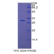 SDS-PAGE analysis of Human ETFa Protein.