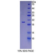 SDS-PAGE analysis of recombinant Rat ESM1 Protein.