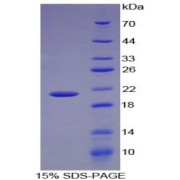 SDS-PAGE analysis of Human ENO1 Protein.