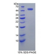 SDS-PAGE analysis of Human EGFR2 Protein.