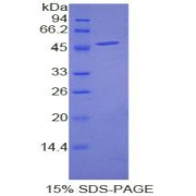 SDS-PAGE analysis of Human Epiregulin Protein.