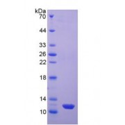 SDS-PAGE analysis of recombinant Human Estrogen Receptor 2 Protein.