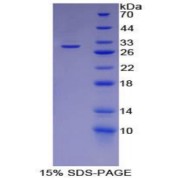 SDS-PAGE analysis of Mouse Basigin Protein.
