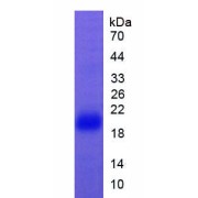SDS-PAGE analysis of Mouse FAS Protein.