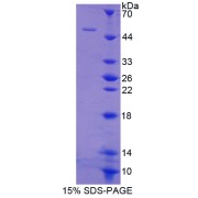 SDS-PAGE analysis of Rat FAS Protein.