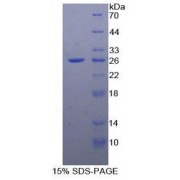 SDS-PAGE analysis of recombinant Human FADD Protein.