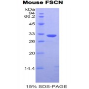 SDS-PAGE analysis of Mouse Fascin Protein.