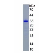 SDS-PAGE analysis of recombinant Human Fascin 2 (FSCN2) Protein.
