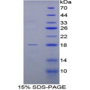 SDS-PAGE analysis of Rat FABP1 Protein.
