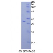 SDS-PAGE analysis of Mouse Fatty Acid Synthase Protein.