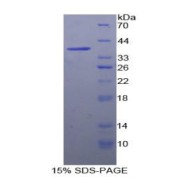 SDS-PAGE analysis of Human Fatty Acid Synthase Protein.