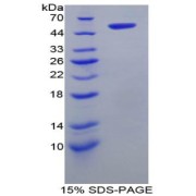 SDS-PAGE analysis of recombinant Rat FATP5 Protein.