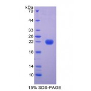 SDS-PAGE analysis of Cow FTL Protein.