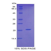 SDS-PAGE analysis of Human Fibrillin 1 Protein.