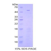 SDS-PAGE analysis of recombinant Mouse Fibrinogen beta Protein.