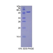 SDS-PAGE analysis of Rat FGF10 Protein.