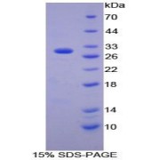 SDS-PAGE analysis of Human FGFR2 Protein.