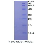 SDS-PAGE analysis of Human FGFR4 Protein.