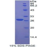 SDS-PAGE analysis of Human FGFRL1 Protein.