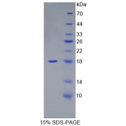 SDS-PAGE analysis of Mouse Fibronectin Protein.