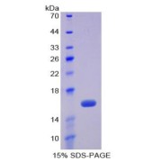 SDS-PAGE analysis of recombinant Human Fibronectin Protein.