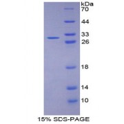SDS-PAGE analysis of recombinant Human Fibulin 1 Protein.
