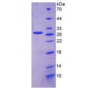 SDS-PAGE analysis of recombinant Human FOLR1 Protein.