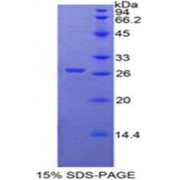 SDS-PAGE analysis of Human Frizzled Homolog 1 Protein.