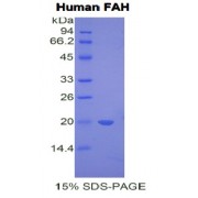 SDS-PAGE analysis of Human FAH Protein.