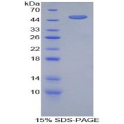 SDS-PAGE analysis of Mouse Furin Protein.