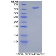 SDS-PAGE analysis of Human Furin Protein.