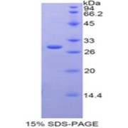 SDS-PAGE analysis of Rat GAL3ST1 Protein.