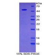 SDS-PAGE analysis of Human GAL3ST1 Protein.