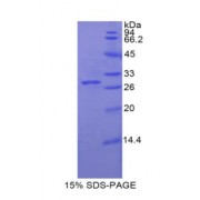 SDS-PAGE analysis of Rat Galactosidase beta Protein.