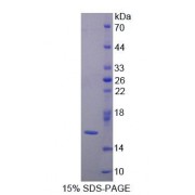 SDS-PAGE analysis of Human Galectin 9B Protein.