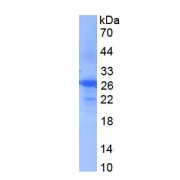 SDS-PAGE analysis of recombinant Mouse Gastrokine 2 (GKN2) Protein.