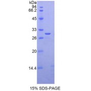 SDS-PAGE analysis of Human GLI3 Protein.
