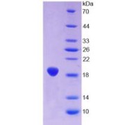 SDS-PAGE analysis of recombinant Rat GFAP Protein.