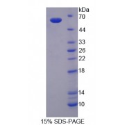 SDS-PAGE analysis of Human G6PD Protein.