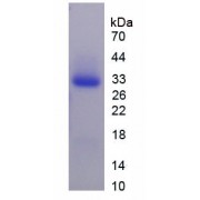 SDS-PAGE analysis of recombinant Human Glucose 6 Phosphate Isomerase (GPI) Protein.