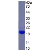 SDS-PAGE analysis of recombinant Human GaA Protein.