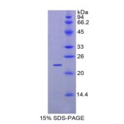 SDS-PAGE analysis of Mouse GaA Protein.