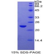 SDS-PAGE analysis of Rat GaA Protein.