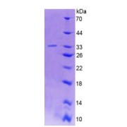 SDS-PAGE analysis of Human GAD2 Protein.