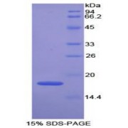 SDS-PAGE analysis of recombinant Mouse GPX4 Protein.
