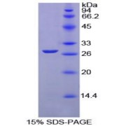 SDS-PAGE analysis of Chicken GSTm1 Protein.