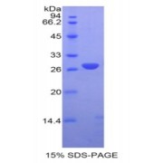 SDS-PAGE analysis of Human GSTm1 Protein.