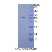 SDS-PAGE analysis of Human GSTm4 Protein.