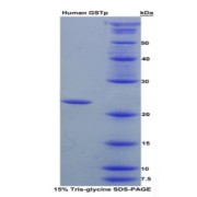 SDS-PAGE analysis of recombinant Human GSTP1 Protein.